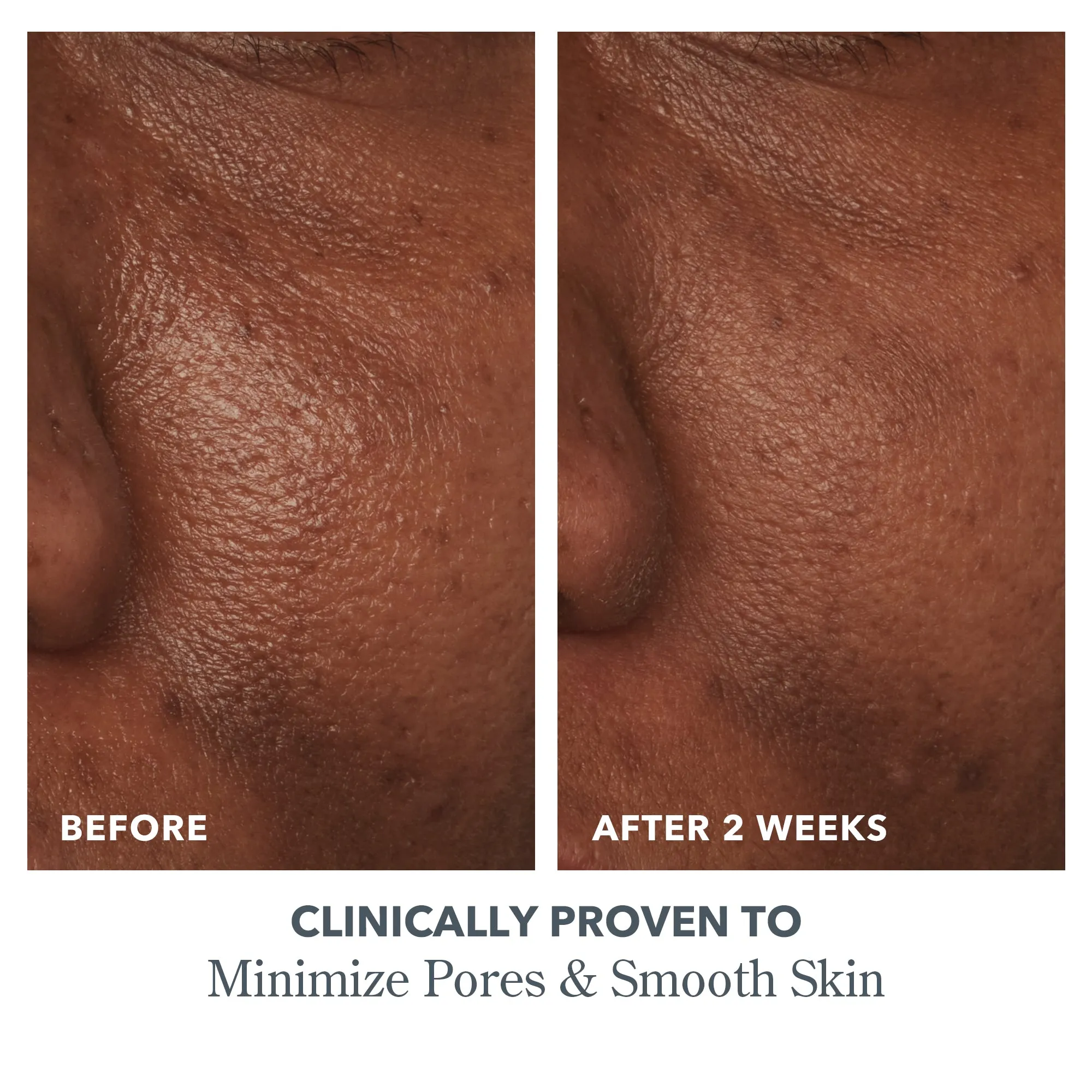 Peel & Glow Bundle